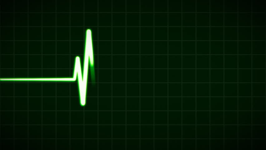 Header of cardiovascular