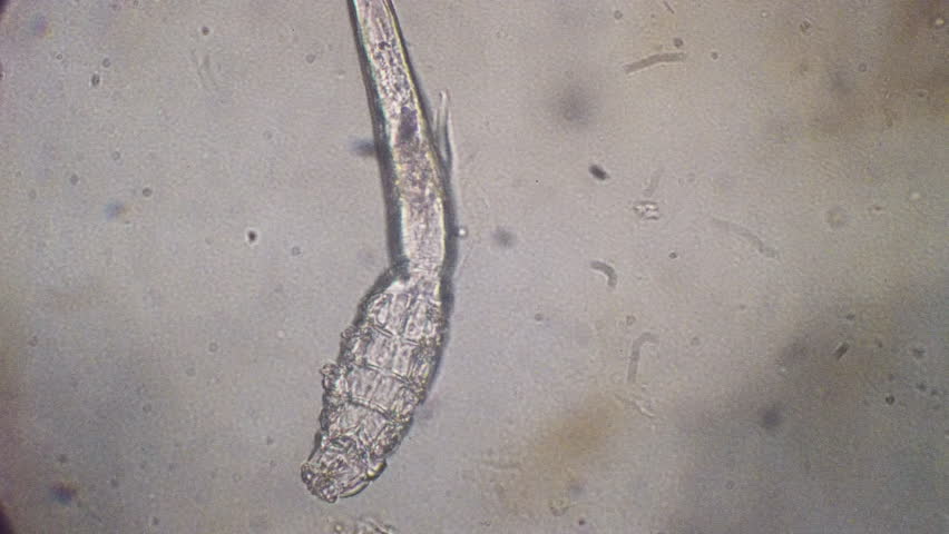  Demodex (Demodex Canis) Seen Under ...