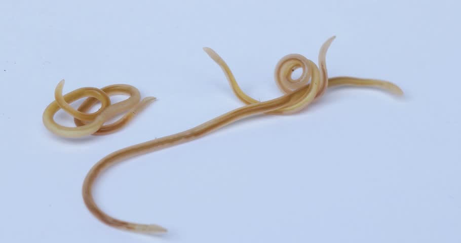 Tapeworm In Human Intestine Stock Footage Video 13994483