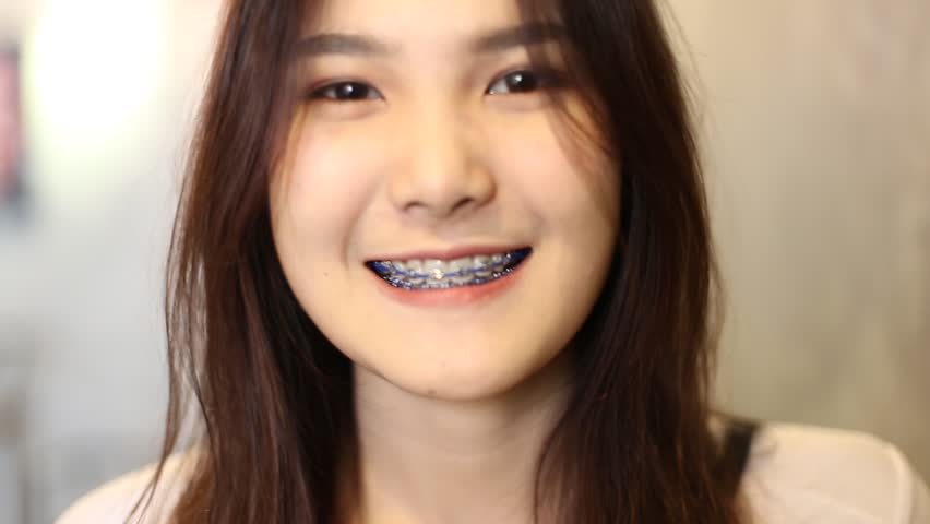 Asian Girl With Braces On Teeth Smiling Stock Footage