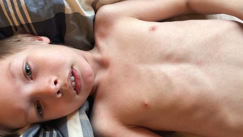 Header of Allergic Reaction