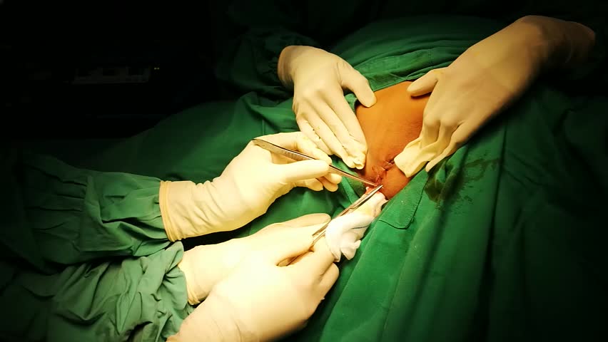 Header of operative