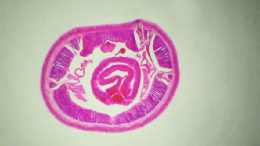 Earthworm Under The Microscope, Background. (Lumbricidae) Stock Footage