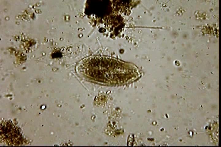 Educational Microscopic. The Protozoan Oxytricha Fallax. Includes ...