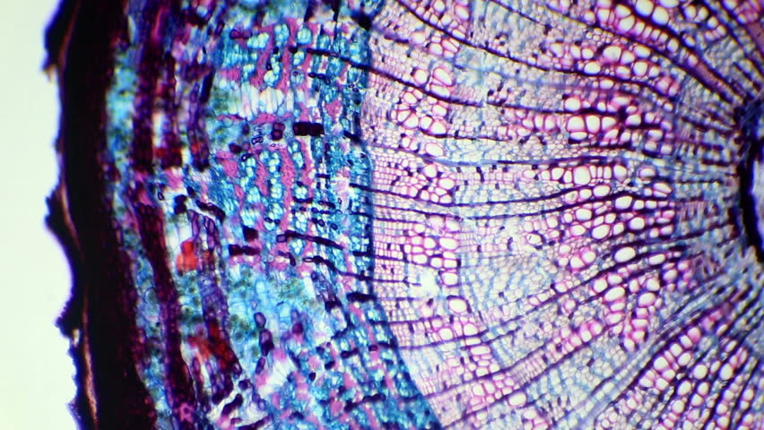 Longitudinal Section Of The Stem Woody Plant Under The Microscope ...